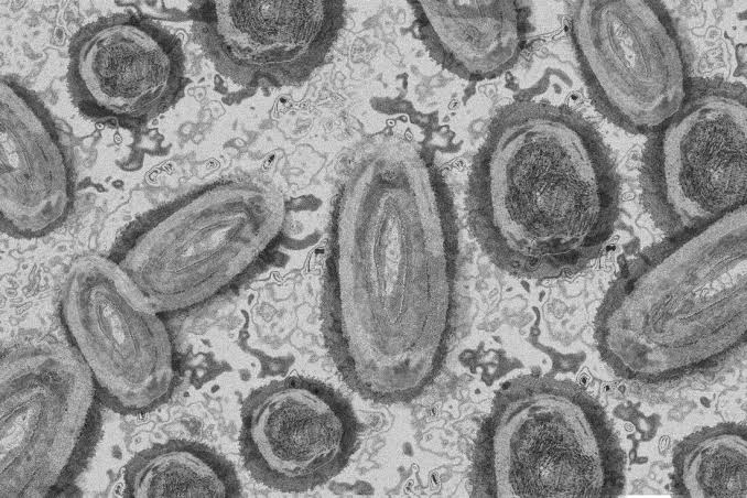 ​Primeiro caso de varíola dos macacos no Brasil é confirmado