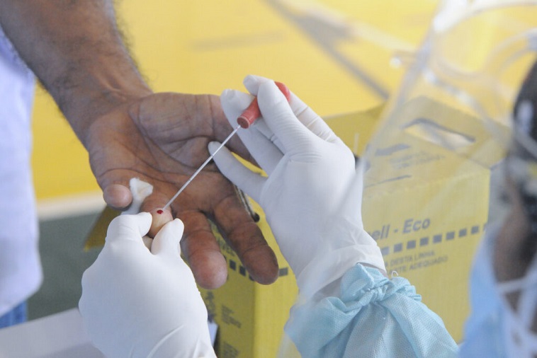 Coronavírus: Bahia registra 590 novos casos e 11 óbitos nas últimas 24h