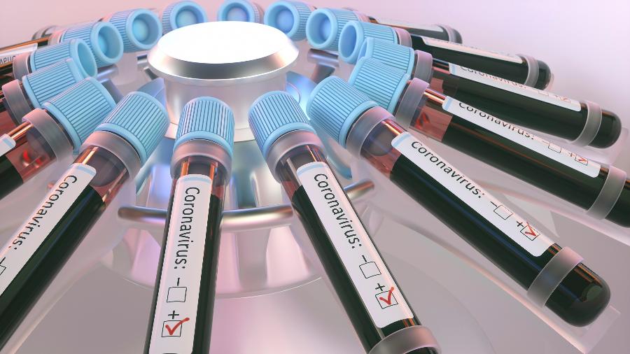 Anvisa aprova aplicação de testes rápidos para covid-19 em farmácias 