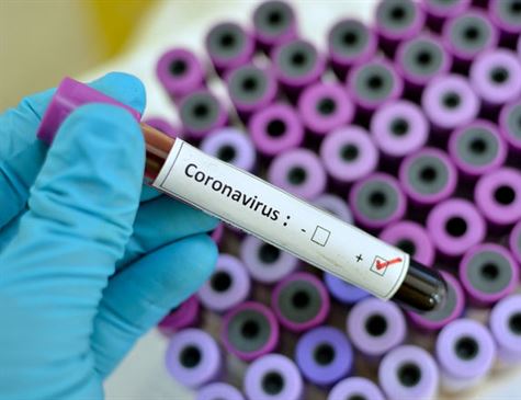 91 casos de novo coronavírus são confirmados na Bahia