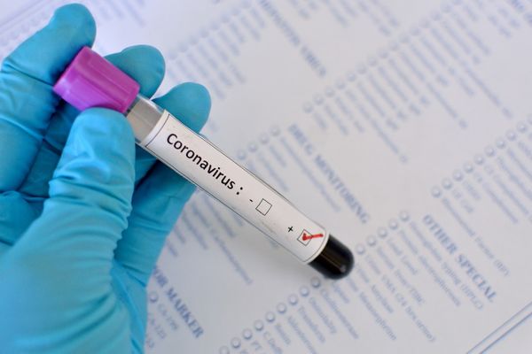 Número de mortes por coronavírus no Brasil chega a 553