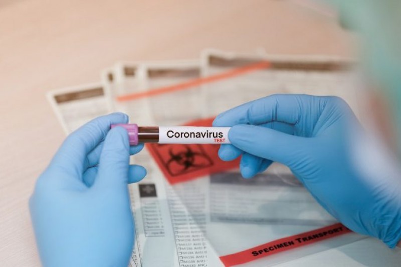 Bahia registra 568 casos confirmados de novo coronavírus