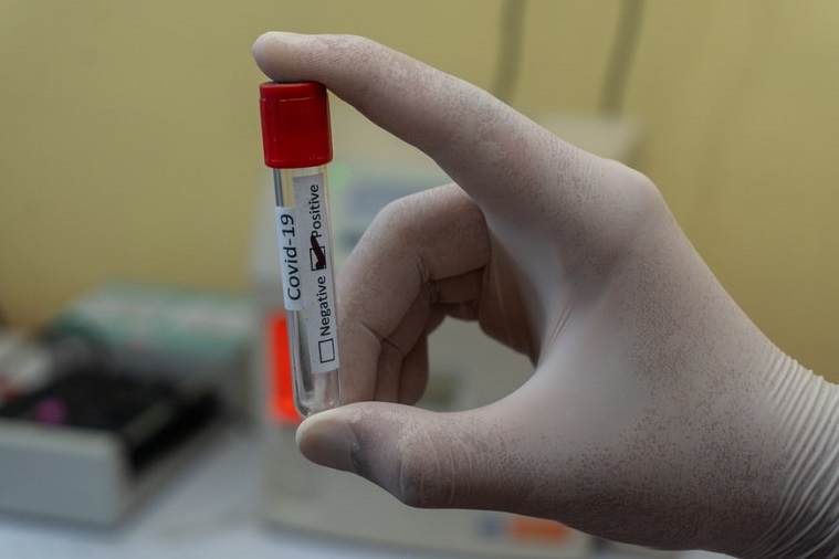 Coronavírus: Bahia registra 2.430 novos casos e 8 óbitos nas últimas 24h