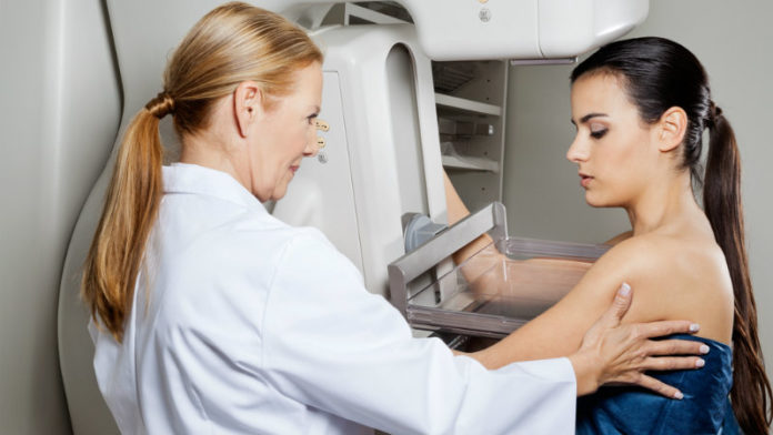 Grupo CAM vai oferecer 200 mamografias gratuitas em Salvador 