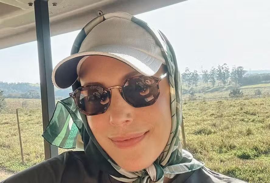 Após transplante de medula óssea, Fabiana Justus revela que está restrita à luz solar; entenda