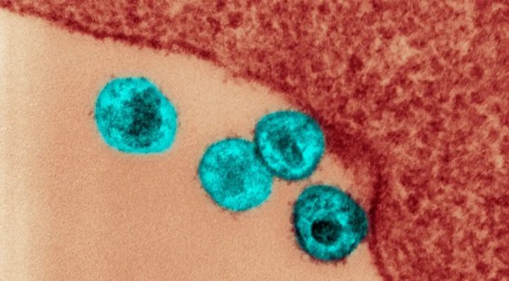 Nova variante do HIV é detectada na Bahia e em outros 2 estados, afirma estudo