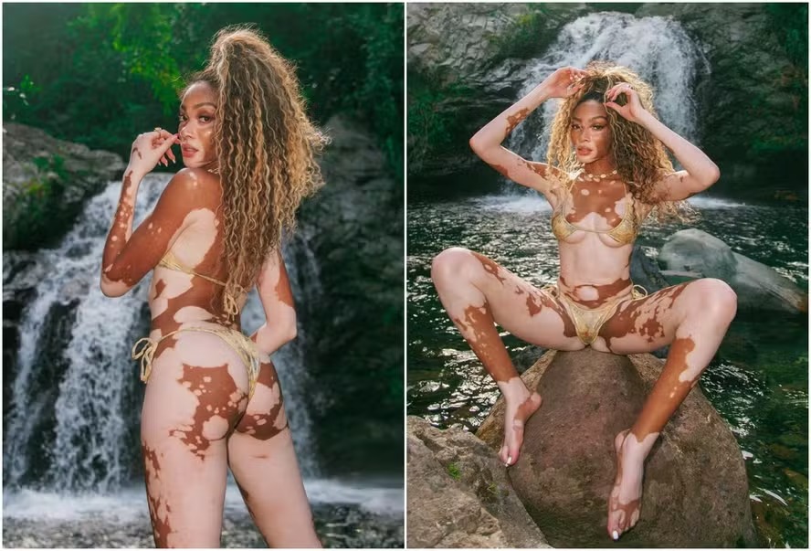 Modelo Winnie Harlow relaxa em cachoeira na Jamaica e web reage: ‘Obra de arte’