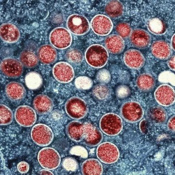 OMS classifica Mpox como ‘emergência sanitária global’