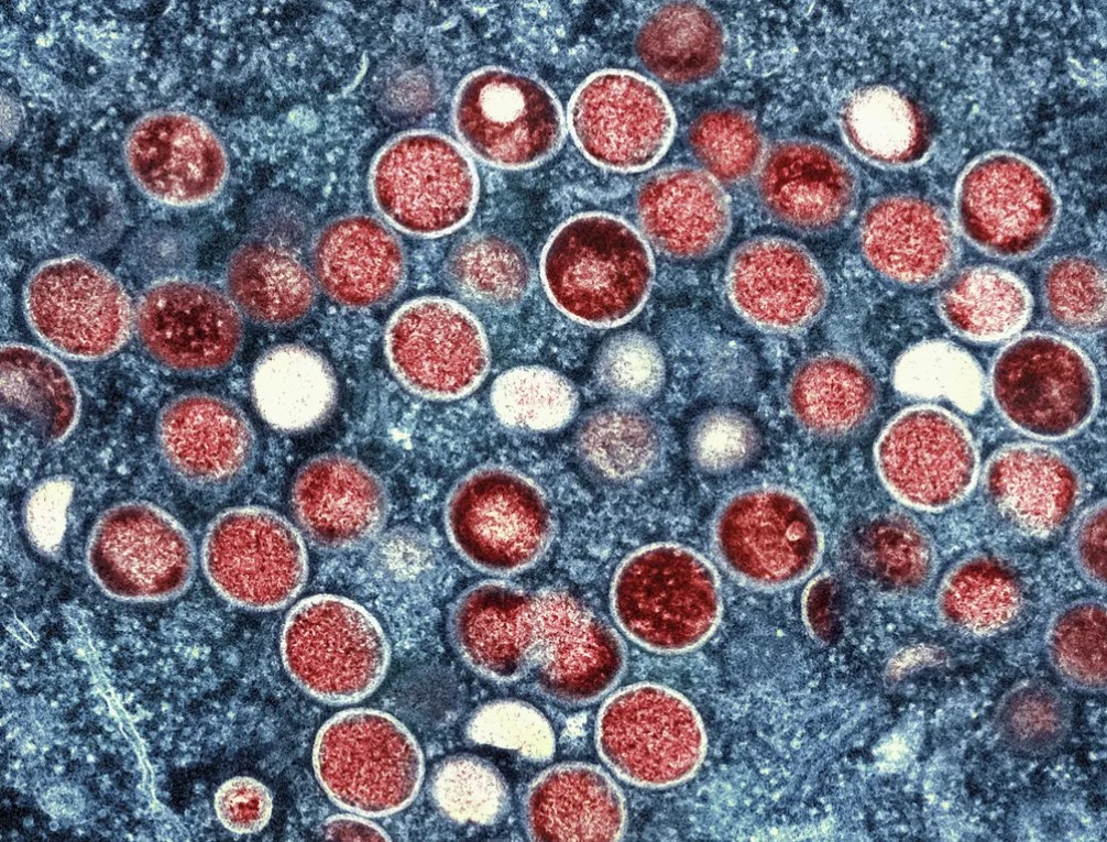 OMS classifica Mpox como ‘emergência sanitária global’