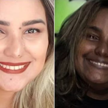 Tumor e síndrome raros fazem jovem brasileira mudar de cor; entenda