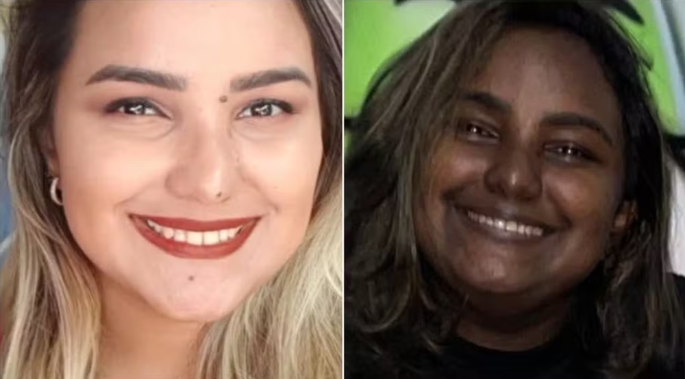 Tumor e síndrome raros fazem jovem brasileira mudar de cor; entenda