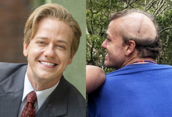 Ator Pablo Sanábio retira tumor no cérebro após sofrer convulsões: ‘Achei que fosse crise de ansiedade’