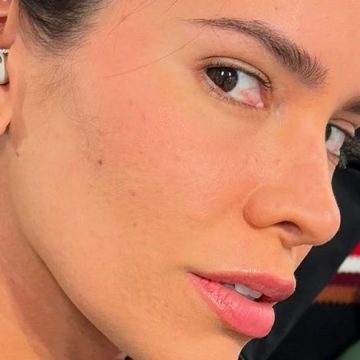 Adriana Sant’Anna descobre doença após crise alérgica: ‘Só a minoria da minoria tem’