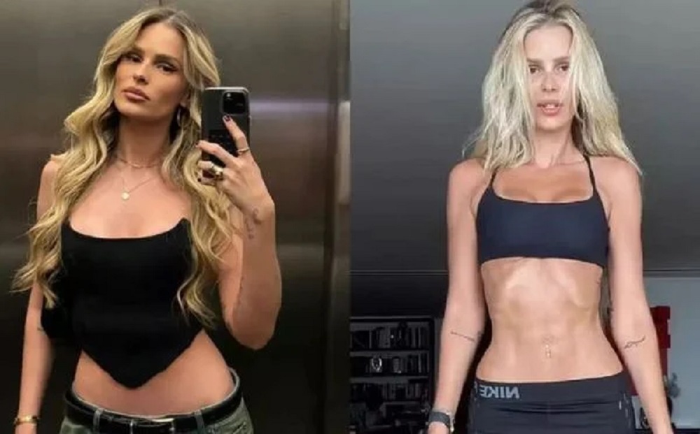 Yasmin Brunet revela quantos quilos perdeu após diagnóstico de doença: ‘Gritava de dor’