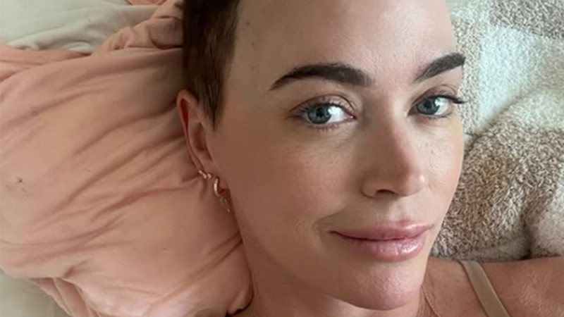 Teddi Mellencamp revela metástase após melanomas e cirurgia no cérebro