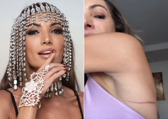 Patrícia Poeta mostra ferimentos após desfile no Carnaval do Rio de Janeiro