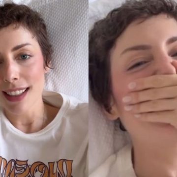 Fabiana Justus diverte ao contar perrengue durante exame: “Segredo cabeludo”