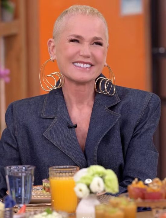 Xuxa revela que fez transplante capilar após diagnóstico de calvície