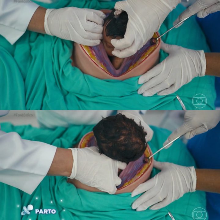 Parto de um bebê reborn mostrado em matéria no “Fantástico” – Foto: Reprodução/TV Globo