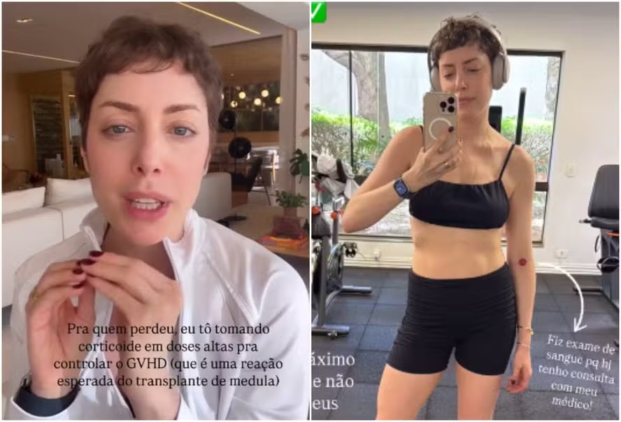 Fabi Justus revela inchaço após ter reação ao transplante de medula: ‘Uns 2 kg’