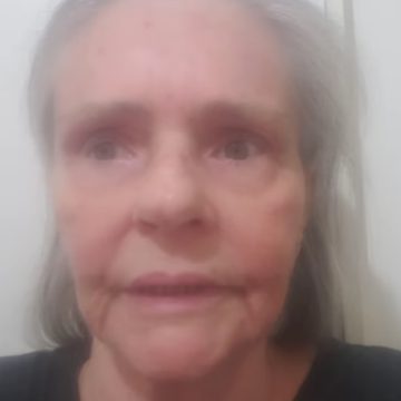 Angela Ro Ro revela suspeita de câncer e pede ajuda de fãs: ‘Sem perspectiva de cura’