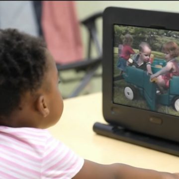 Exame inovador promete revolucionar diagnóstico do autismo em bebês