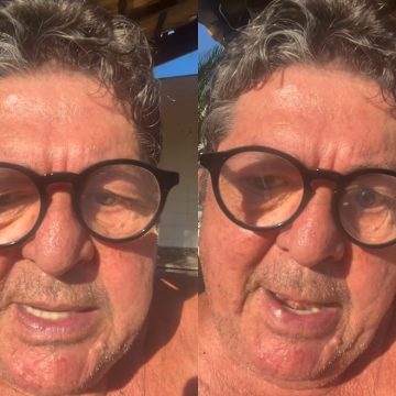 Stepan Nercessian adere à caneta emagrecedora e desabafa sobre resultado: ‘Maldita’