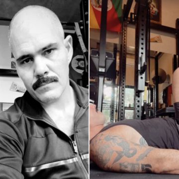Juliano Cazarré exibe cicatriz após cirurgia no joelho; veja