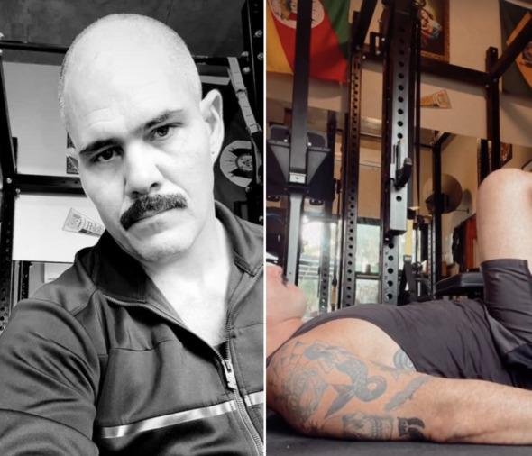 Juliano Cazarré exibe cicatriz após cirurgia no joelho; veja