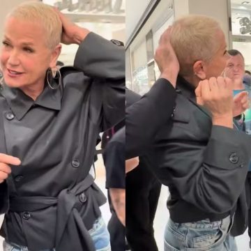Xuxa exibe evolução de implante capilar: ‘Está crescendo’