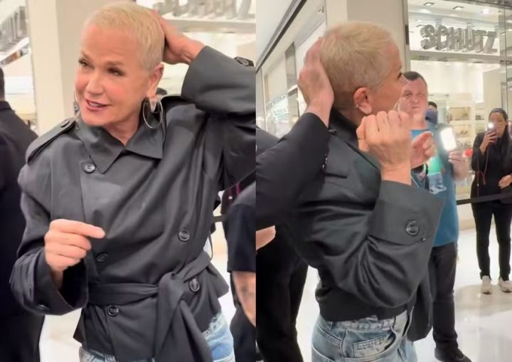 Xuxa exibe evolução de implante capilar: ‘Está crescendo’