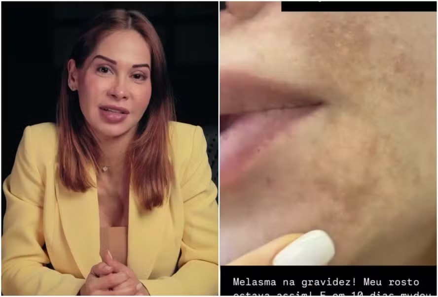 Grávida, Maíra Cardi procura médico após surgimento de problema inesperado