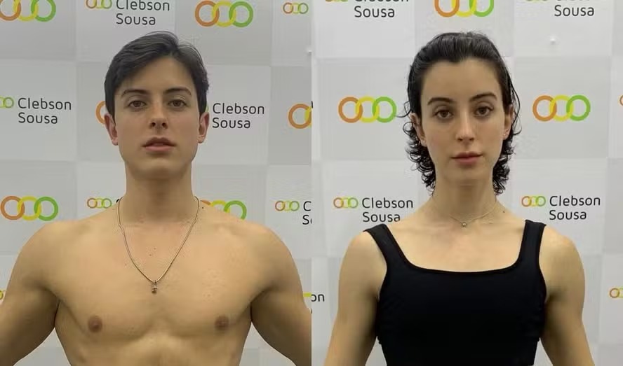 Bella Longuinho mostra antes e depois da transição de gênero: ‘Agora sou mais eu’