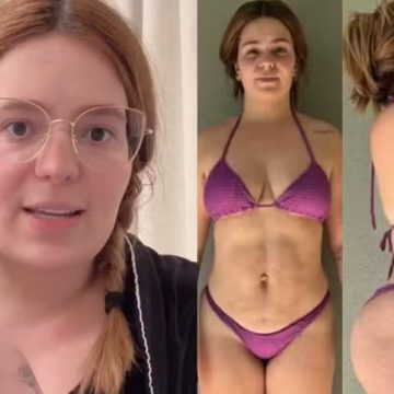 Excesso de pele, aréolas grandes e mais: Viih Tube lista incômodos que a levaram a fazer combo de cirurgias