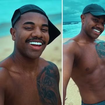 Davi Brito exibe novo visual após lipo, harmonização e lente nos dentes