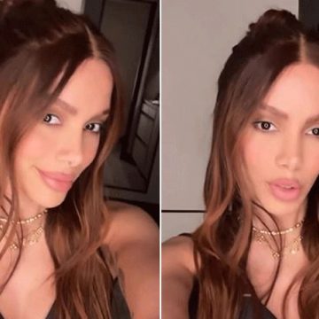 Após Anitta reaparecer com ‘novo rosto’ na internet, especialistas listam possíveis procedimentos estéticos