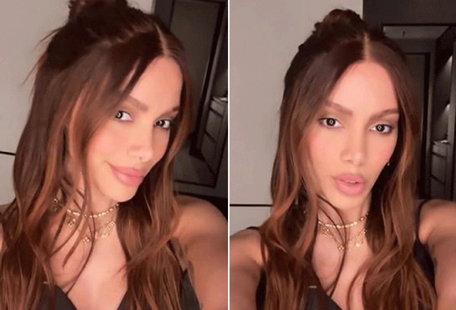 Após Anitta reaparecer com ‘novo rosto’ na internet, especialistas listam possíveis procedimentos estéticos