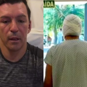 Ex-jogador Lúcio inicia recuperação após ter 18% do corpo queimado