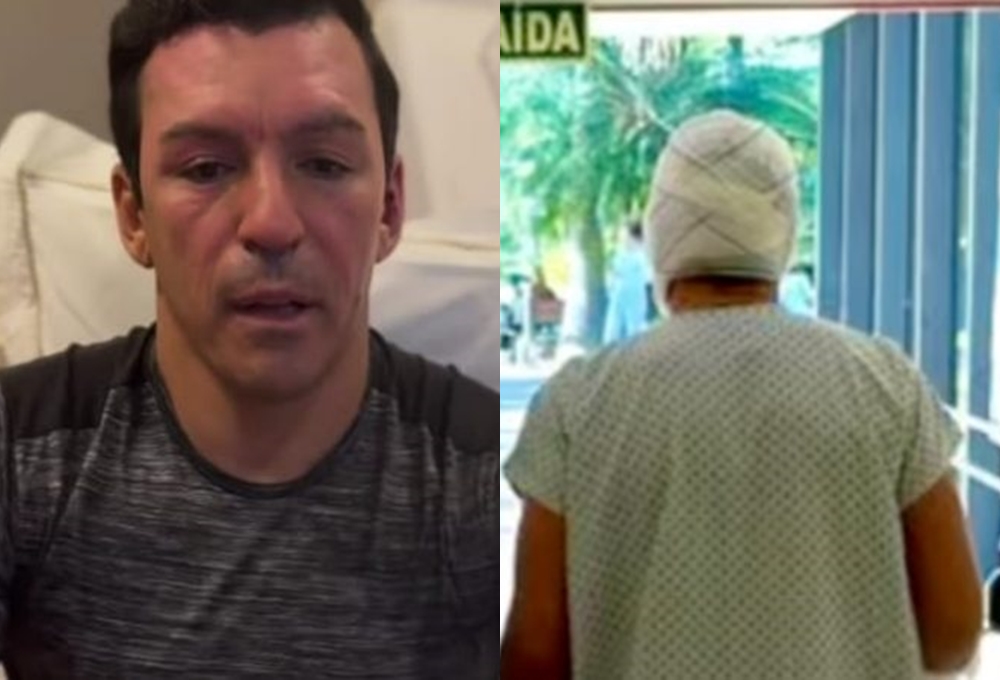 Ex-jogador Lúcio inicia recuperação após ter 18% do corpo queimado
