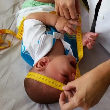 Congresso derruba veto e garante pensão vitalícia a vítimas da zika