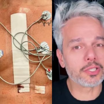 Otaviano Costa relembra diagnóstico de aneurisma e fala sobre superação: ‘Descobri que podia morrer’