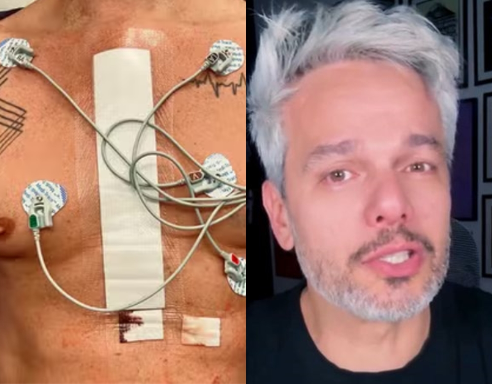 Otaviano Costa relembra diagnóstico de aneurisma e fala sobre superação: ‘Descobri que podia morrer’