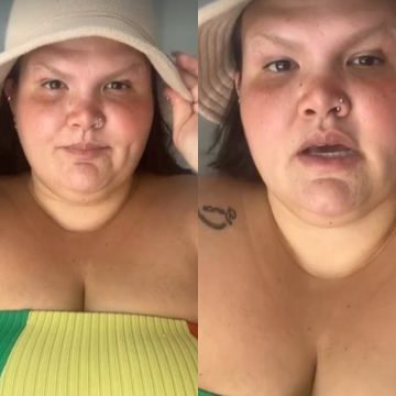 Thais Carla revela problema capilar após bariátrica: ‘Se agravou’