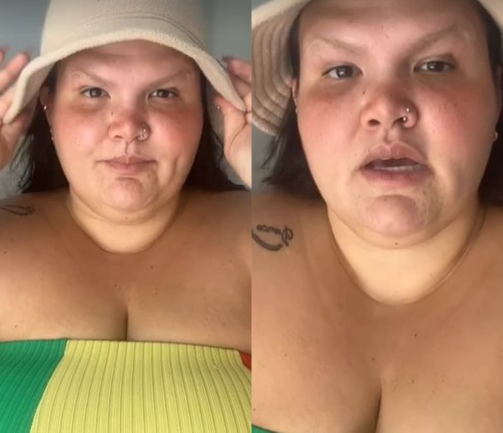Thais Carla revela problema capilar após bariátrica: ‘Se agravou’