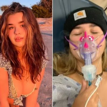 Alerta: modelo enfrenta falência dos pulmões após fumar mistura de maconha com tabaco