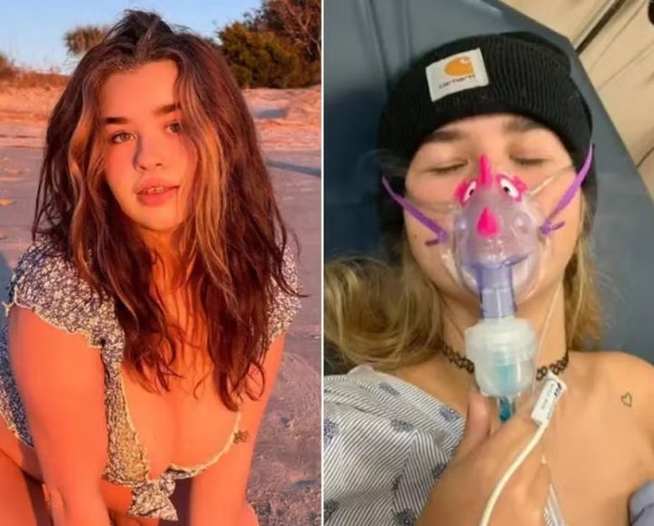 Alerta: modelo enfrenta falência dos pulmões após fumar mistura de maconha com tabaco