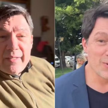 Icônico ‘Cigano Igor’, Ricardo Macchi faz harmonização facial aos 55 anos