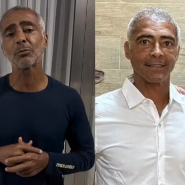 Romário muda visual e faz transplante capilar aos 59 anos