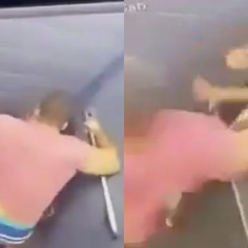Agredida com 60 socos, mulher terá que reconstruir ossos do rosto