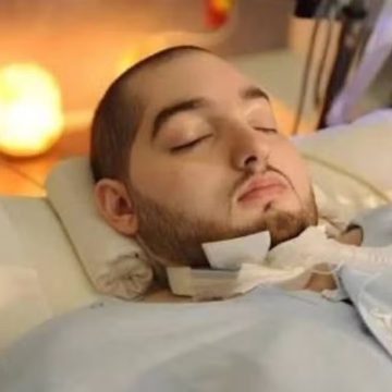 Morre o ‘Príncipe Adormecido’, que passou mais de 20 anos em coma após acidente de carro